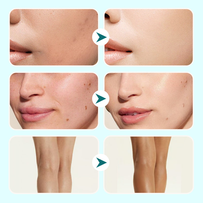 🔥Laatste dag - Koop 1, krijg 1 gratis!🎁【Netto-inhoud: 100 mL】Alles-in-één moisturizer, concealer en dekking 💧✨ Lichtgewicht en waterdicht