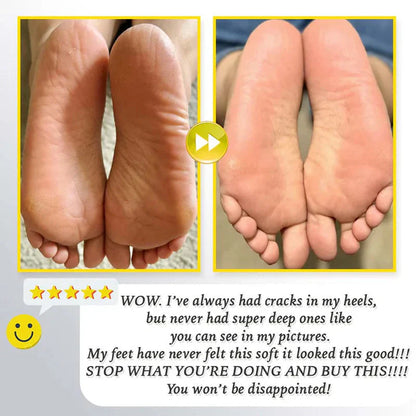 Oplaadbare elektrische scrub voor voeten