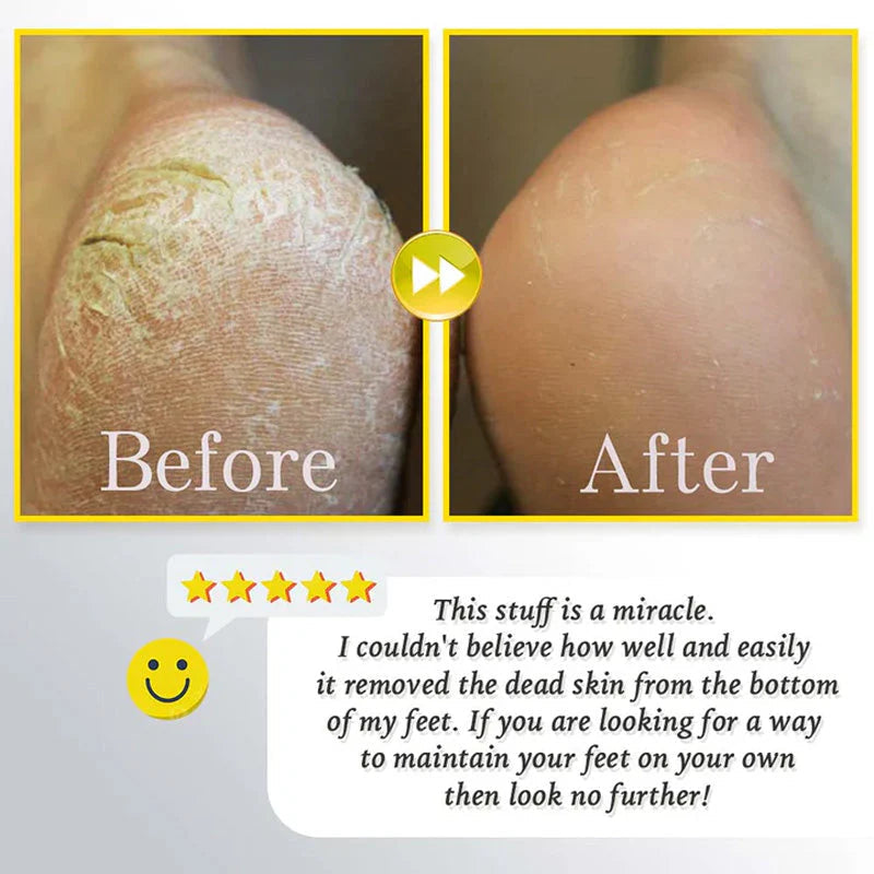 Oplaadbare elektrische scrub voor voeten