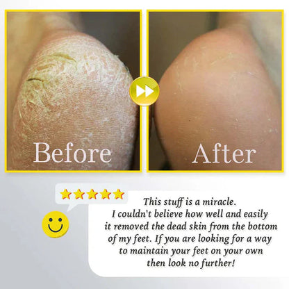 Oplaadbare elektrische scrub voor voeten