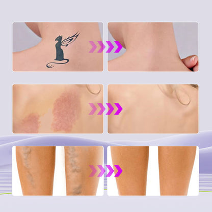 💜🎁Tijdelijke aanbieding: KOOP 1, KRIJG 1 GRATIS!! 💜Alles-in-één moisturizer, concealer & dekking Perfector