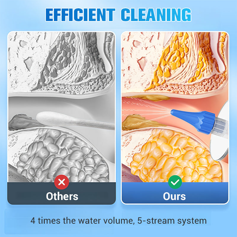 👂 SPECIALE AANBIEDING! ⚡Oorwaxverwijderingsset – veilig en zacht, herbruikbare siliconenlepel, gebruiksvriendelijk, voor een effectieve en hygiënische reiniging van de oren ✨
