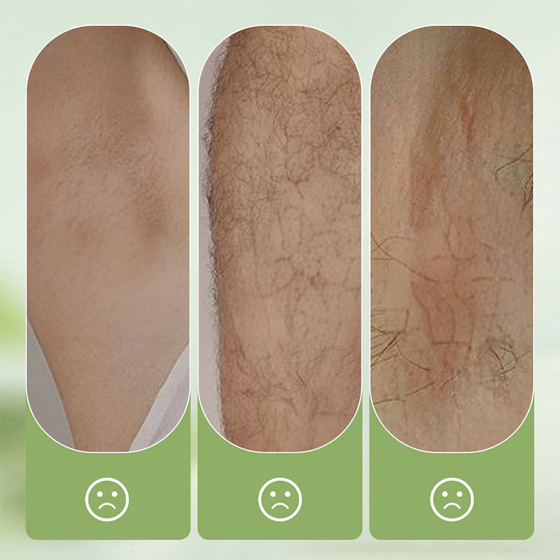 🧴 50% KORTING! 🪒 Zachte en milde set – Ontharingscrème + scheermesje – Pijnloos voor de gevoelige huid, geen donkere vlekken of stoppels 🌸