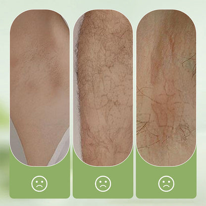 🧴 50% KORTING! 🪒 Zachte en milde set – Ontharingscrème + scheermesje – Pijnloos voor de gevoelige huid, geen donkere vlekken of stoppels 🌸